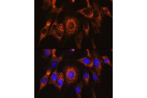 Immunofluorescence analysis of NIH/3T3 cells using UB Rabbit pAb (ABIN7271120) at dilution of 1:100. (UBAC2 抗体  (AA 220-310))
