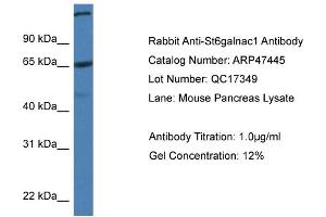 Western Blotting (WB) image for anti-ST6 (Alpha-N-Acetyl-Neuraminyl-2,3-beta-Galactosyl-1,3)-N-Acetylgalactosaminide alpha-2,6-Sialyltransferase 1 (ST6GALNAC1) (C-Term) antibody (ABIN785365) (ST6GALNAC1 抗体  (C-Term))