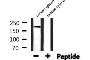 Western blot analysis of extracts from mouse spleen, using FANCM Antibody. (FANCM 抗体  (Internal Region))
