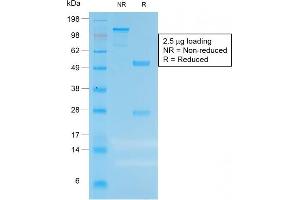 SDS-PAGE (SDS) image for anti-Carcinoembryonic Antigen-Related Cell Adhesion Molecule 5 (CEACAM5) antibody (ABIN6939079)