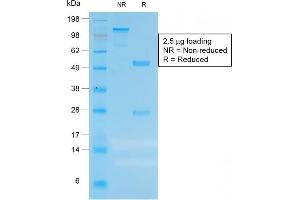 SDS-PAGE Analysis of Purified CEA Rabbit Recombinant Monoclonal Antibody (C66/1983R). (Recombinant CEACAM5 抗体)
