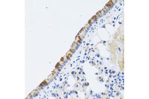 Immunohistochemistry of paraffin-embedded rat lung using ST3GAL3 antibody (ABIN2560155) at dilution of 1:100 (40x lens). (ST3GAL3 抗体)
