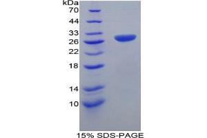 SDS-PAGE analysis of Mouse TRAF1 Protein. (TRAF1 蛋白)