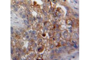 IHC-P analysis of Lung tissue, with DAB staining. (DDR2 抗体  (AA 578-817))
