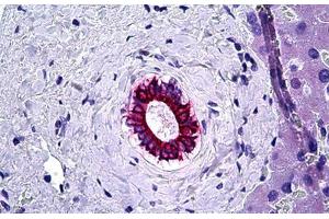 Human Liver, Bile Duct: Formalin-Fixed, Paraffin-Embedded (FFPE) (KRT8 抗体)