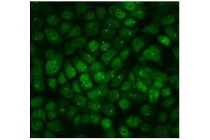 IF analysis of PPM1E using anti-PPM1E antibody (ABIN7600049).