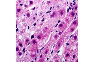 Immunohistochemical analysis of Tyrosinase staining in human liver formalin fixed paraffin embedded tissue section. (TYR 抗体  (C-Term))