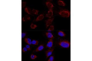 Confocal immunofluorescence analysis of U2OS cells using HADHA Polyclonal Antibody (ABIN6131741, ABIN6141585, ABIN6141587 and ABIN6217258) at dilution of 1:100. (HADHA 抗体  (AA 484-763))