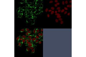 Confocal Immunofluorescence image of HeLa cells stained with Clathrin, HC Monoclonal Antibody (CHC/1432) followed by Goat anti-Mouse CF488 (green). (Clathrin Heavy Chain (CLTC) 抗体)