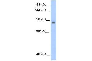 ACO1 antibody used at 0. (Aconitase 1 抗体  (N-Term))