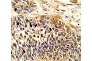 Immunohistochemistry (IHC) image for anti-Wingless-Type MMTV Integration Site Family, Member 4 (WNT4) (AA 211-239) antibody (ABIN3029633)