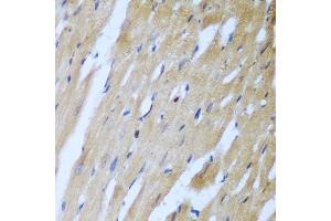 Immunohistochemistry of paraffin-embedded rat heart using ROCK1 antibody.