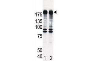 Western blot analysis of EGF Receptor antibody and HeLa cell lysate, either induced (Lane 1) or noninduced with EGF (2). (EGFR 抗体  (AA 1048-1077))