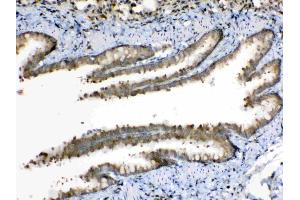 Immunohistochemistry (IHC) image for anti-Periplakin (PPL) (AA 1664-1701), (C-Term) antibody (ABIN5518787)