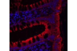 IHC-P Image Immunohistochemical analysis of paraffin-embedded human colon, using JAM-B, antibody at 1:200 dilution. (JAM2 抗体)