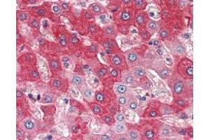 Immunohistochemical analysis of paraffin-embedded human liver tissues using FGFR4 mAb. (FGFR4 抗体)