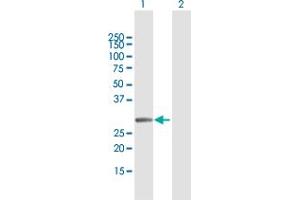 Western Blot analysis of MMS19 expression in transfected 293T cell line by MMS19 MaxPab polyclonal antibody. (MMS19 抗体  (AA 1-293))