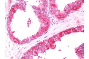 Immunohistochemistry (IHC) image for anti-Collagen, Type IV, alpha 3 (Goodpasture Antigen) Binding Protein (COL4A3BP) (N-Term) antibody (ABIN1978859)
