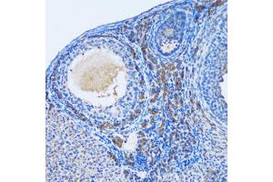 Immunohistochemistry of paraffin-embedded rat ovary using OGDH antibody. (alpha KGDHC 抗体)