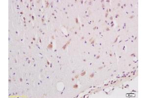 Formalin-fixed and paraffin embedded rat brain labeled with Anti phospho-B-Raf (Ser602) Polyclonal Antibody, Unconjugated (ABIN745373) at 1:200 followed by conjugation to the secondary antibody and DAB staining (SNRPE 抗体  (pSer602))