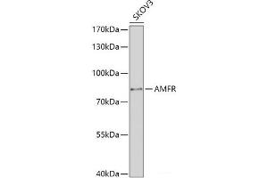 Western blot analysis of extracts of SKOV3 cells using AMFR Polyclonal Antibody at dilution of 1:1000. (AMFR 抗体)