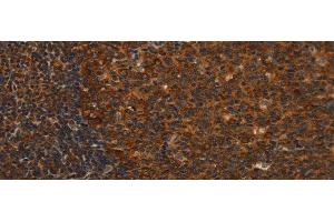 Immunohistochemistry of paraffin-embedded Human tonsil tissue using MIP Polyclonal Antibody at dilution 1:40 (Mip 抗体)