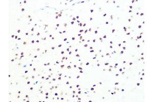 Immunohistochemistry of paraffin-embedded rat brain using DKC1 Rabbit mAb (ABIN7266869) at dilution of 1:100 (40x lens). (DKC1 抗体)