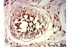 Immunohistochemical analysis of paraffin-embedded testis tissues using SP17 mouse mAb with DAB staining. (SPA17 抗体  (AA 1-152))