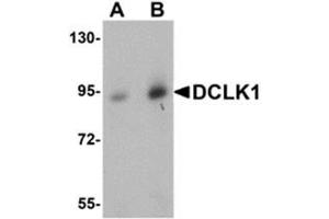 Western blot analysis of DCLK1 in human brain tissue lysate with AP30276PU-N DCLK1 antibody at (A) 0. (DCLK1 抗体  (N-Term))