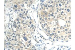 Immunohistochemistry (IHC) image for anti-Calmodulin Like Protein 3 (CALML3) (AA 1-149) antibody (ABIN7436177)