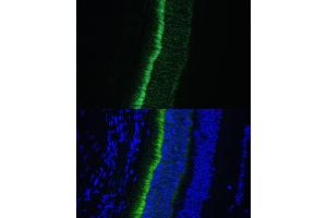 Immunofluorescence analysis of mouse eye using GNGT1 Polyclonal Antibody (ABIN7267288) at dilution of 1:100 (40x lens). (GNGT1 抗体  (AA 1-45))