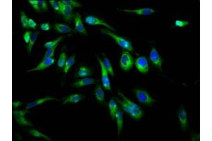 Immunofluorescence staining of Hela cells with ABIN7163704 at 1:66, counter-stained with DAPI. (PLXNB1 抗体  (AA 664-837))