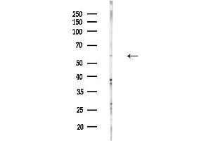 anti-TNF Receptor-Associated Factor 4 (TRAF4) (Internal Region) antibody