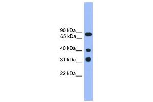 WB Suggested Anti-LAX1  Antibody Titration: 0. (LAX1 抗体  (C-Term))