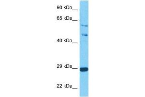 Host:  Rabbit  Target Name:  SPIC  Sample Tissue:  Human Jurkat Whole Cell  Antibody Dilution:  1ug/ml (SPIC 抗体  (C-Term))