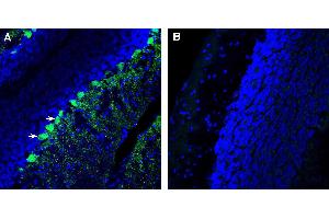 Expression of CaVγ7 in mouse cerebellum.