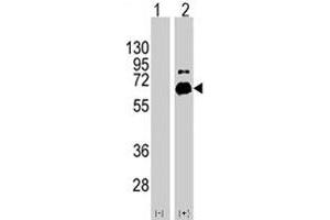 Western blot analysis of RPS6KB1 (arrow) using RPS6KB1 polyclonal antibody . (RPS6KB1 抗体  (Ser424))