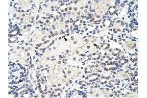 MRM1 antibody was used for immunohistochemistry at a concentration of 4-8 ug/ml to stain Epithelial cells of renal tubule (arrows) in Human Kidney. (MRM1 抗体)