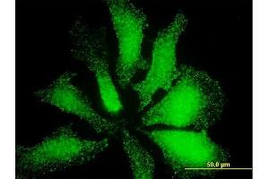 Immunofluorescence of monoclonal antibody to LMO3 on HeLa cell. (LMO3 抗体  (AA 91-146))