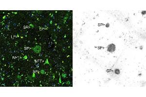 Immunohistochemical analysis of paraffin-embedded Alzheimer’s hippocampus using Thioflavin S (left panel) and ABIN1580412 using the HRP-DAB staining technique. (beta Amyloid 抗体)