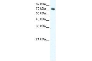 DVL1 antibody used at 2. (DVL1 抗体)