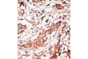 Image no. 1 for anti-Docking Protein 4 (DOK4) (C-Term) antibody (ABIN359961) (DOK4 抗体  (C-Term))