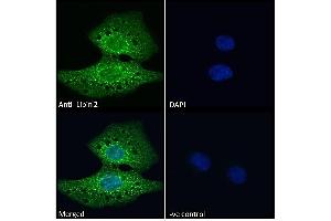 ABIN185361 Immunofluorescence analysis of paraformaldehyde fixed U2OS cells, permeabilized with 0. (Lipin 2 抗体  (C-Term))