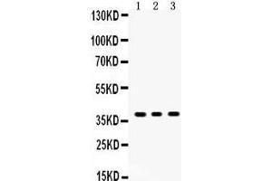 Anti- SIRT6Picoband antibody, Western blotting All lanes: Anti SIRT6  at 0. (SIRT6 抗体  (AA 14-180))