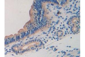 Immunohistochemistry (IHC) image for anti-Laminin, beta 2 (Laminin S) (LAMB2) (AA 1498-1716) antibody (ABIN7438904)