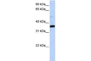 WB Suggested Anti-LTB4DH Antibody Titration: 0. (PTGR1 抗体  (N-Term))