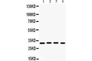 Western Blotting (WB) image for anti-Kv Channel Interacting Protein 2 (KCNIP2) (AA 78-112), (N-Term) antibody (ABIN3043273) (KCNIP2 抗体  (N-Term))