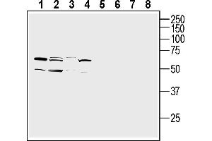 Western blot analysis of Malme-3 skin fibroblast cell line lysates (lanes 1 and 5), human  monocytic leukemia cell line lysate (lanes 2 and 6), human Jurkat T-cell leukemia cell line lysate (lanes 3 and 7) and human  retinal pigmental epithelia cell line lysate (lanes 4 and 8):1-4. (OPN3 抗体  (Extracellular))
