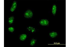 Immunofluorescence of purified MaxPab antibody to EXOSC5 on HeLa cell.