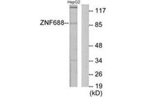 Western blot analysis of extracts from HepG2 cells, using ZNF785 Antibody. (ZNF785 抗体  (AA 91-140))